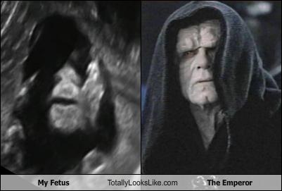 My Fetus Totally Looks Like The Emperor