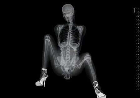 X-Ray Pin Up Kalender