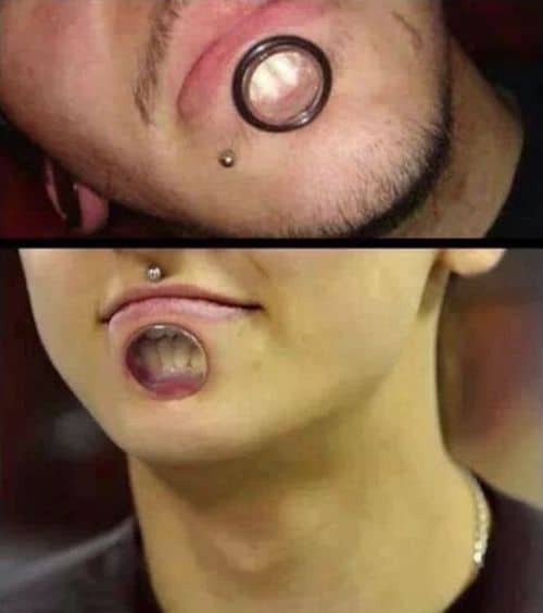 Zähne zeigen mit Lip Plates