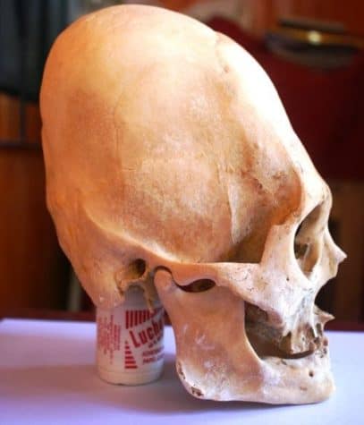 L'analisi del DNA dei lunghi crani peruviani mostra che non c'erano umani