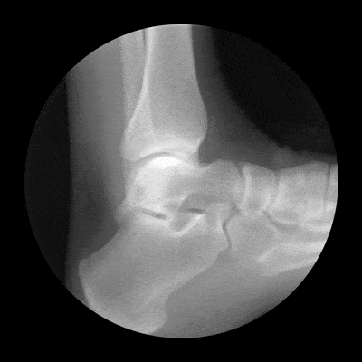 Feed X-Ray