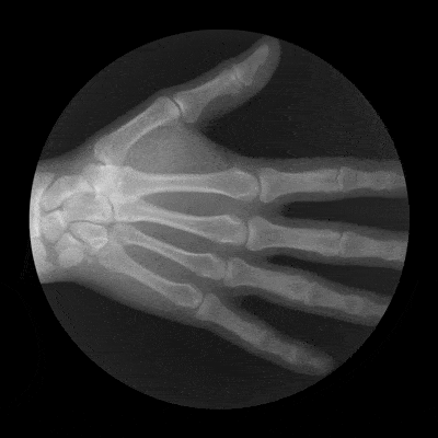 Hand X-Ray
