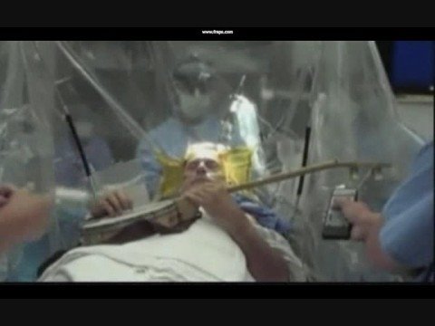 Hra na banjo během operace mozku