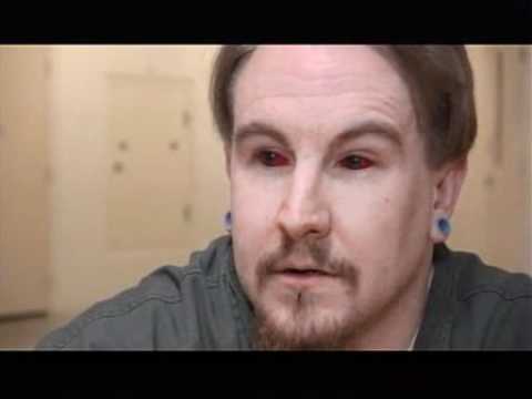 Tattoo the whites of the eyes