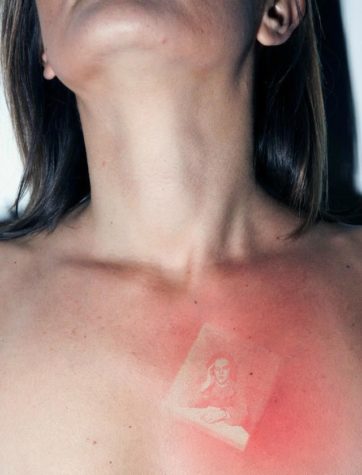 Tatuaże ze zdjęciami oparzeń słonecznych
