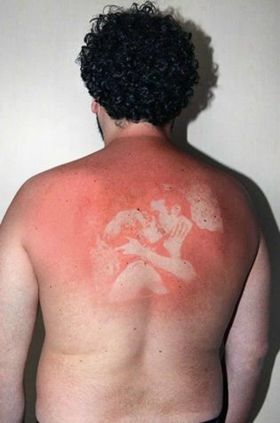 Güneş yanığı fotoğraf dövmeleri