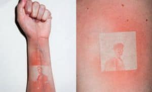 Tatuagens fotográficas de queimaduras solares