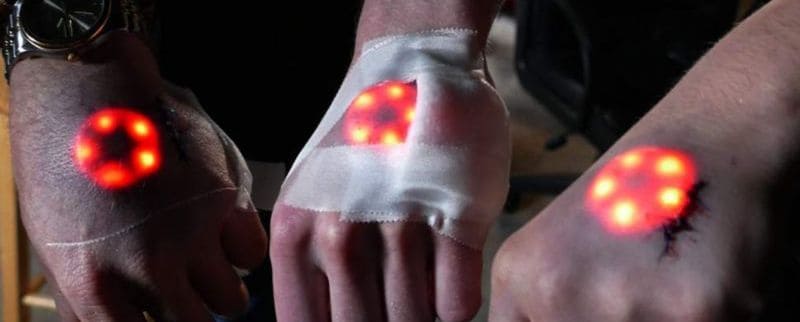 The latest biohacking trend: implantation of an arc reactor under the skin