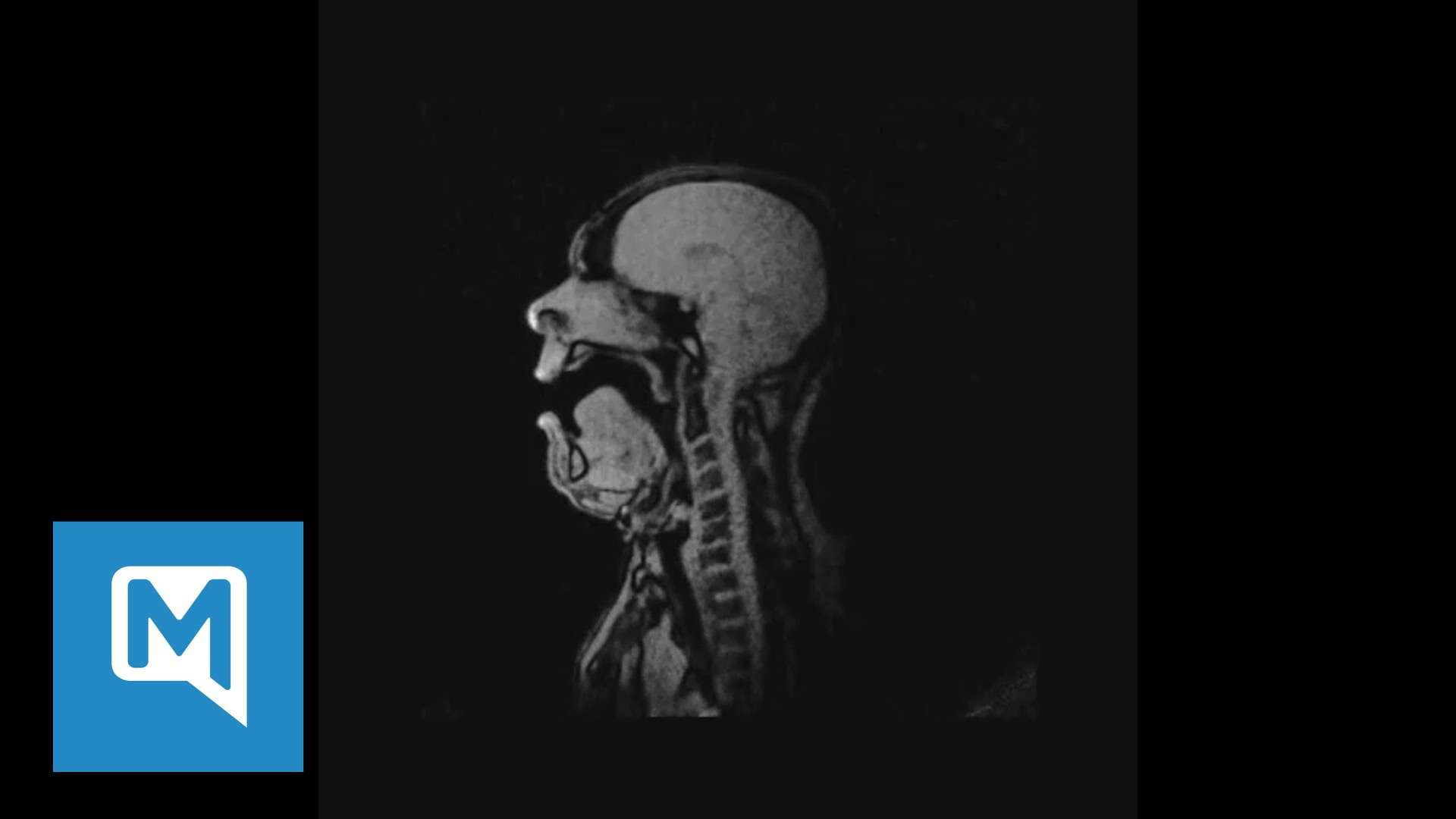 Opern singen im MRI