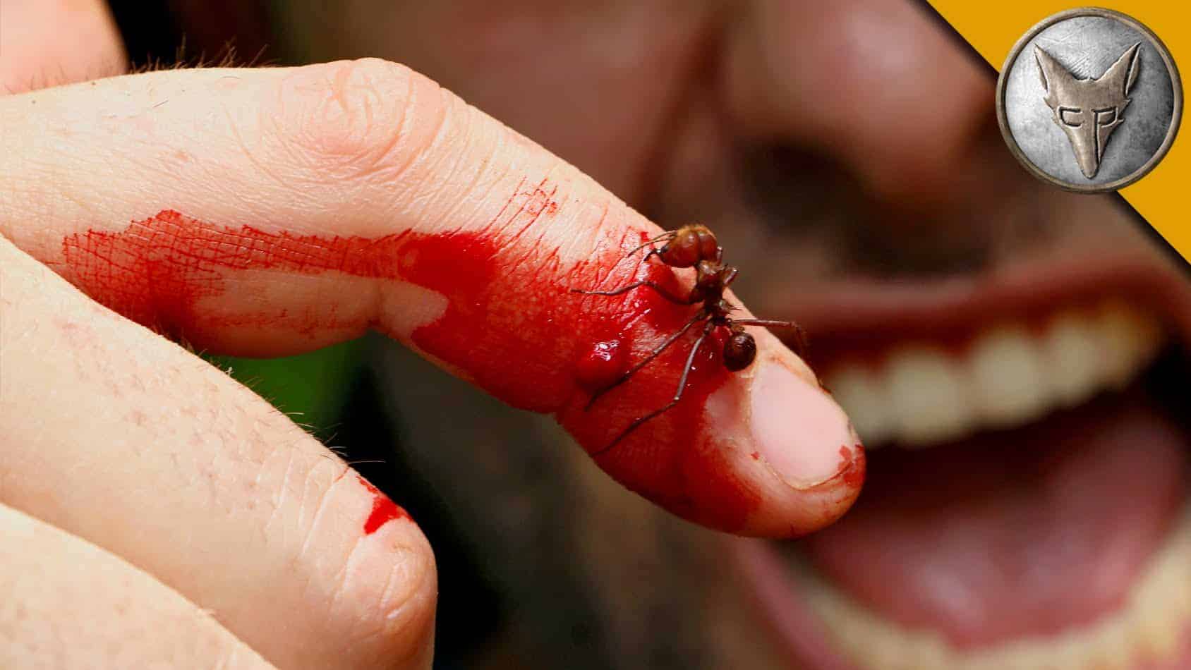 Wenn eine Blattschneiderameise einen Finger zernagt