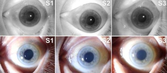 Biometrie van dode ogen