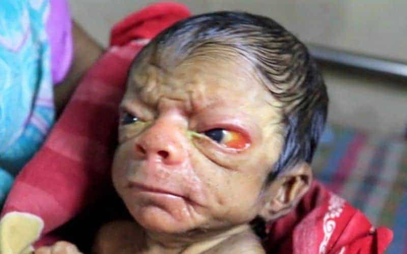 Das seltsamste Baby der Geschichte spricht im Alter von 2 Monaten