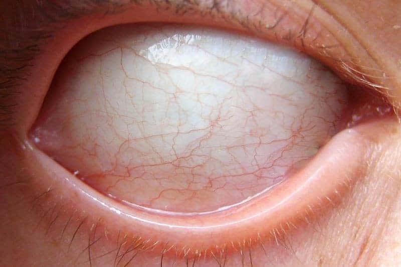 Das Weisse im Auge Dravens Tales from the Crypt