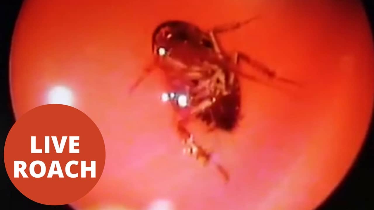Læger opdager levende kakerlakker i en kvindes hoved