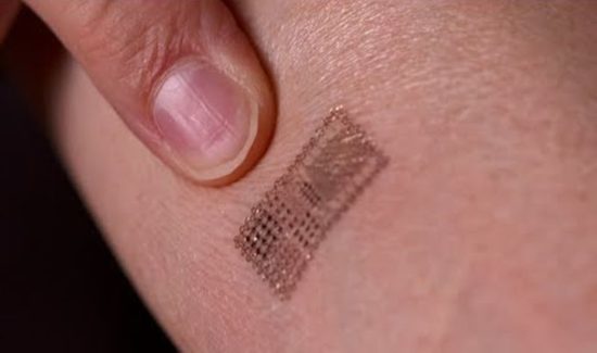 Der Impfpass der Zukunft geht unter die Haut, wie das Massachusetts Institute of Technology (MIT) zeigt