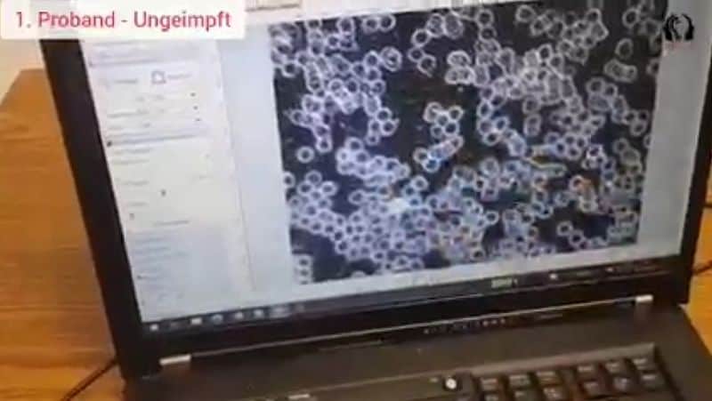 Vergleich des Blutbildes von Geimpften und Ungeimpften