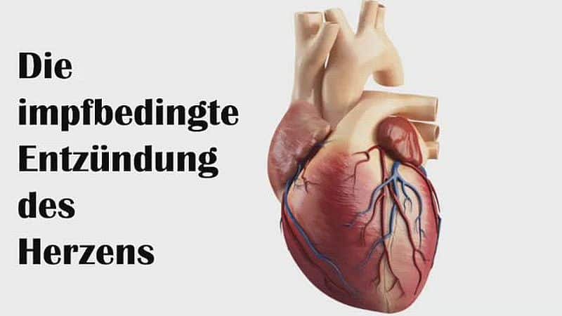 Die impfbedingte Entzündung des Herzens