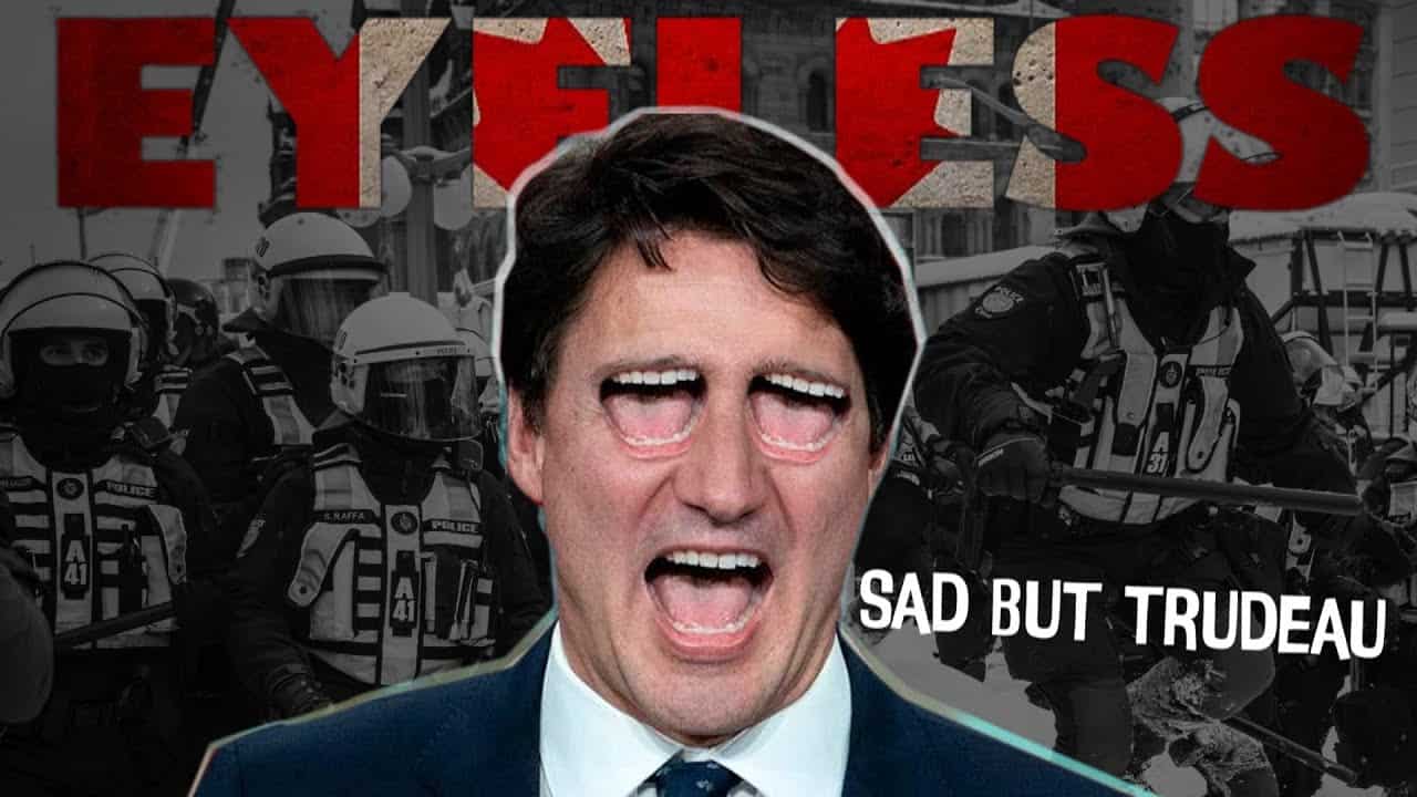Sad But Trudeau &#8211; EYeLesS