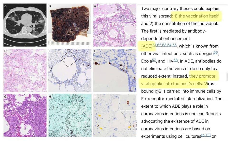 Weltweit erste Studie mit Autopsien geimpfter Covid-Toter