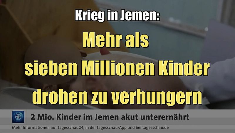 Krieg in Jemen: Mehr als 7 Millionen Kinder drohen zu verhungern