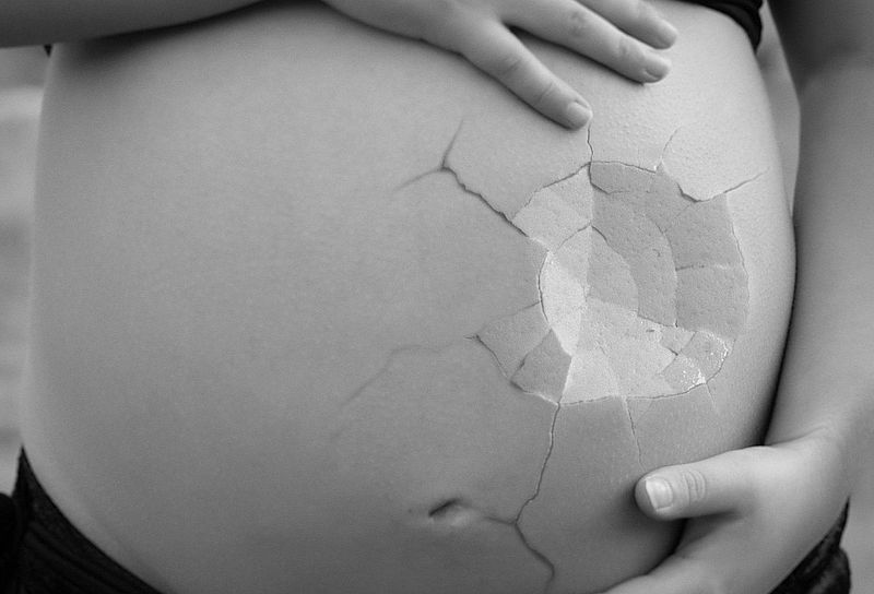 Die Rate der Fehlgeburten ist im Laufe eines einzigen Jahres um das 8.