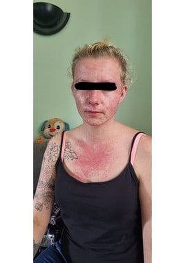 Impfnebenwirkungen: Das ist unfassbar tragisch, wie die Menschen betrogen wurden