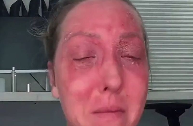 Impfnebenwirkungen: Es ist unfassbar tragisch, wie die Menschen betrogen wurden