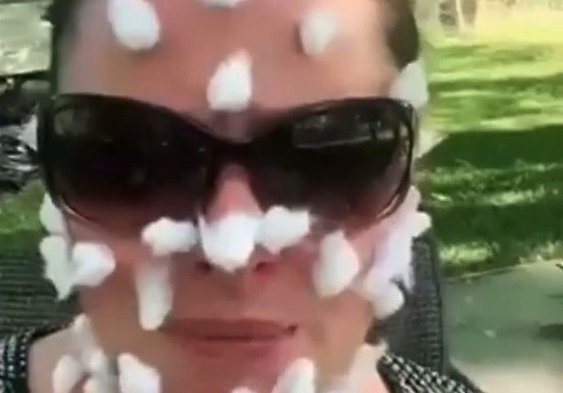 Habt ihr schon von Schafpocken gehört?