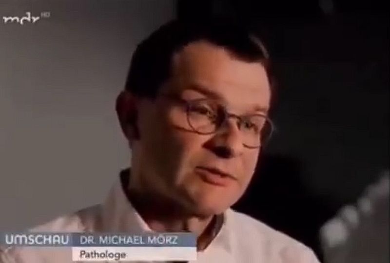 Kopfschmerzen durch die Impfung