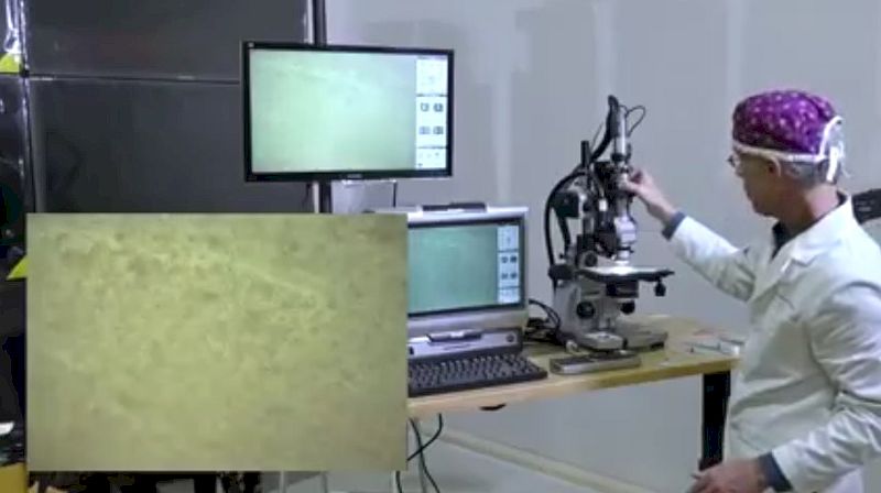 Wenn die mRNA-Impfung auf Blut trifft