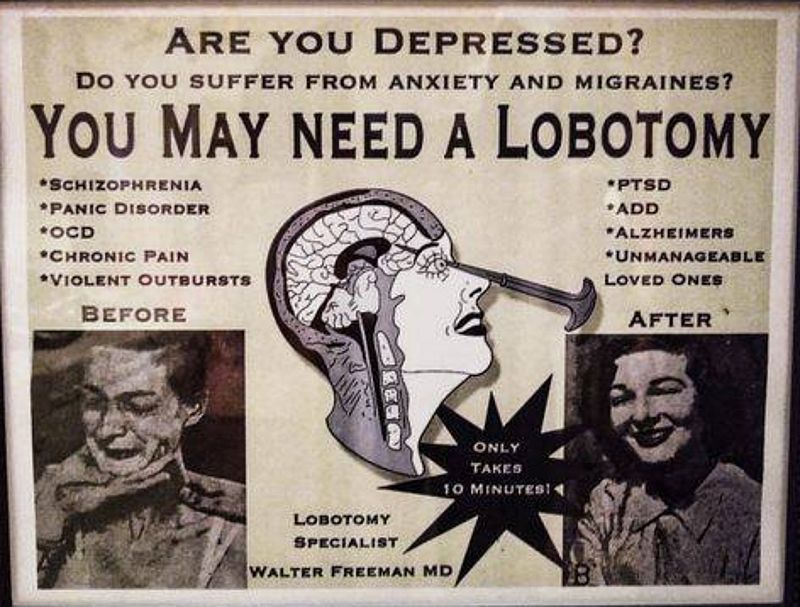 Auch bei der Lobotomie glaubte man der Wissenschaft