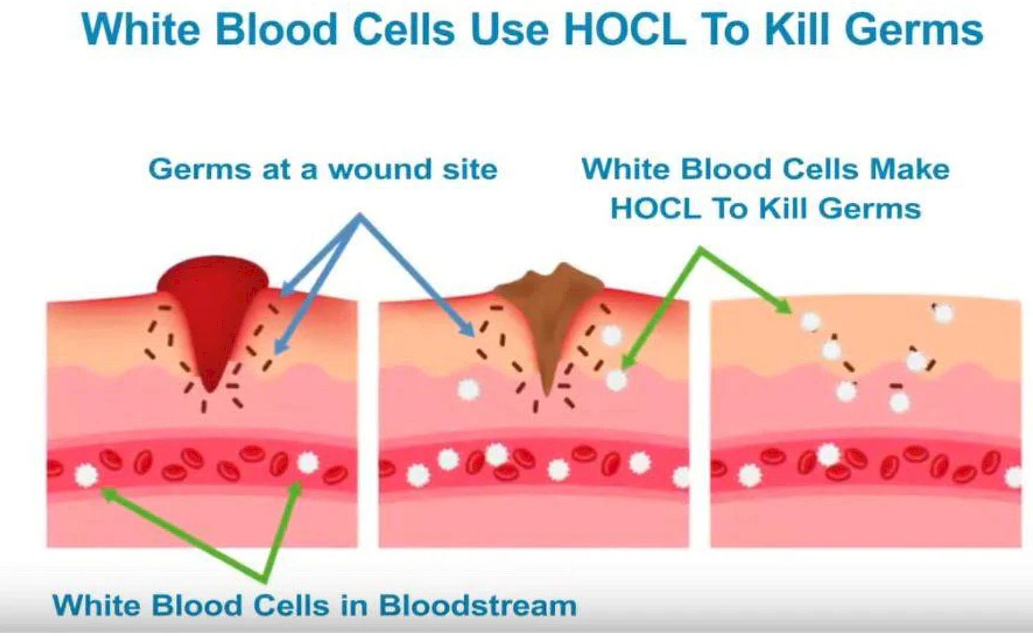 Was wäre, wenn dein Körper sein eigenes antimikrobielles Mittel produzieren würde?