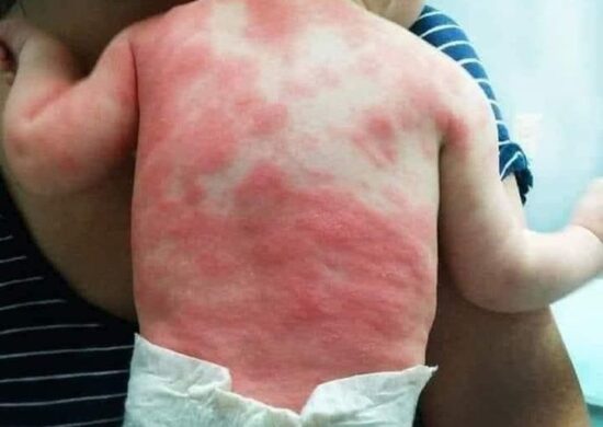 Impfungen pumpen uns mit Giften voll