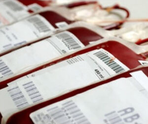 Slaba kri – preobrat v intenzivni medicini