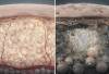 Stau im Gewebe – der Ursprung von Cellulite und Krankheit